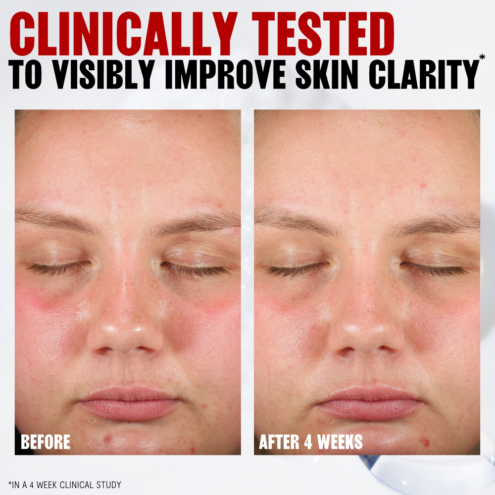 Thayers Pore Refining pads W Witch Hazel & Salicylic Acid 60pads - Image 3 of 8