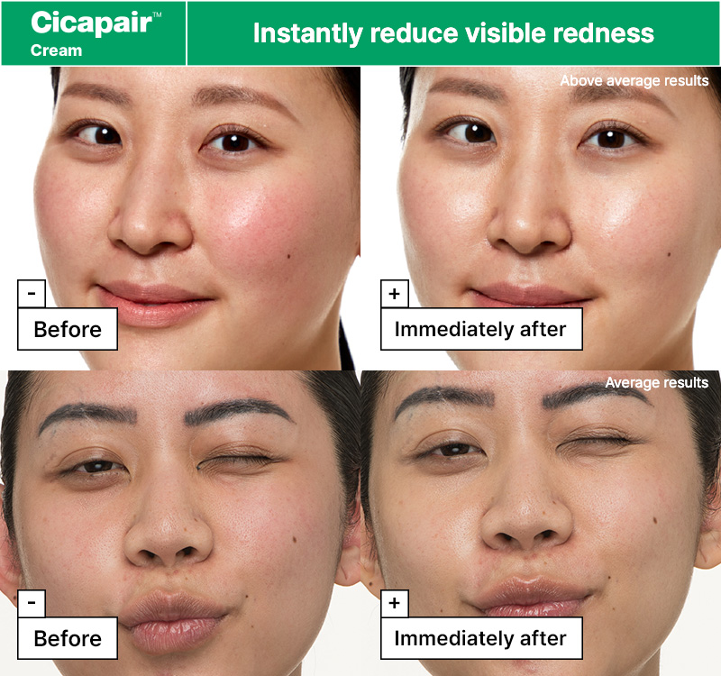 Dr.Jart+ Cicapair™ Redness Rescue Regimen Kit : Mask 0.88 oz. + Serum 0.23 fl. oz. + Cream 0.50 fl. oz. + Treatment 0.50 fl. oz.  - Image 7 of 8