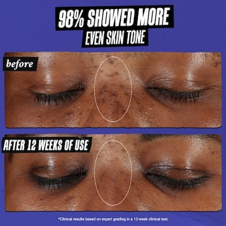 Kiehl's Clearly Corrective Dark Spot Solution 1.0 fl. oz.(30ml) - Image 3 of 6