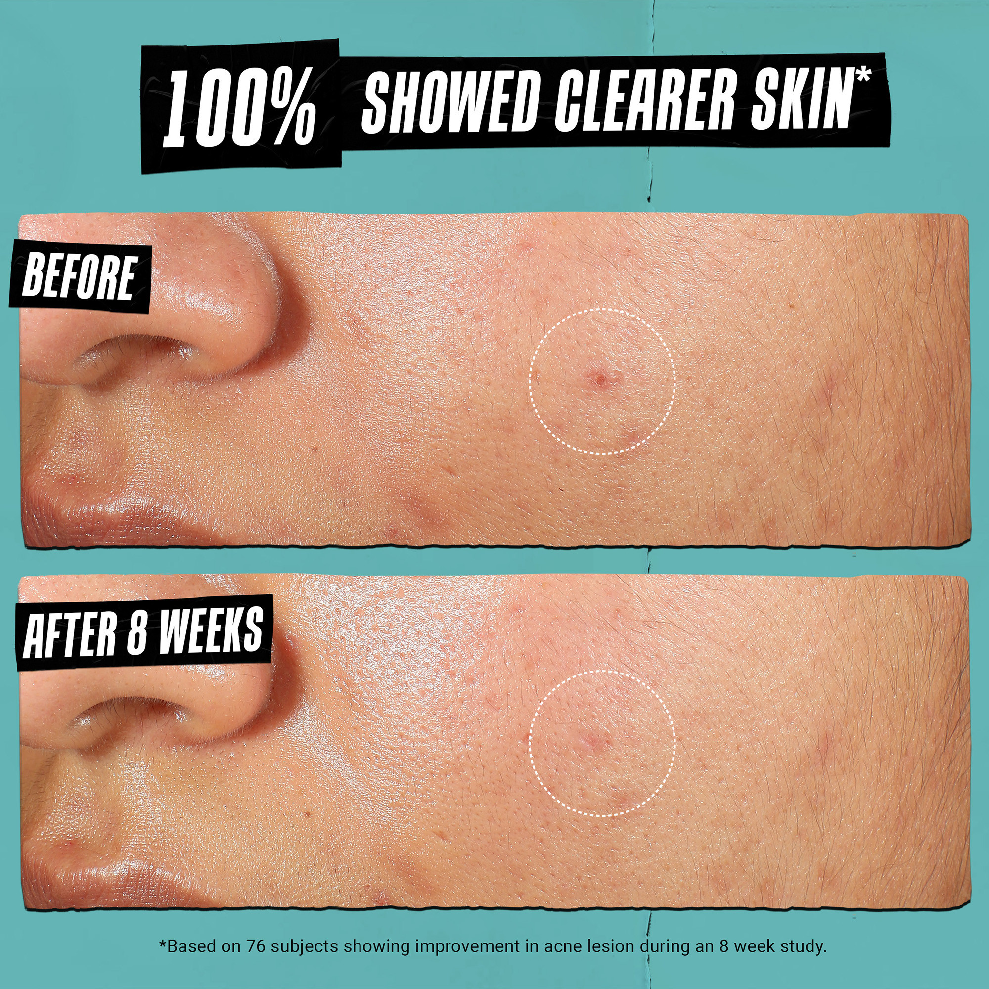 Kiehl's Expertly Clear Moisturizer For Acne Prone Skin With Salicylic Acid 2.0 fl. oz.(60ml) - Image 2 of 8