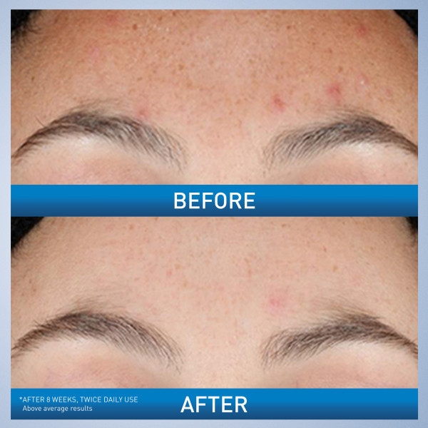 CeraVe Resurfacing Serum 1 fl. oz.(30ml) - Image 3 of 6