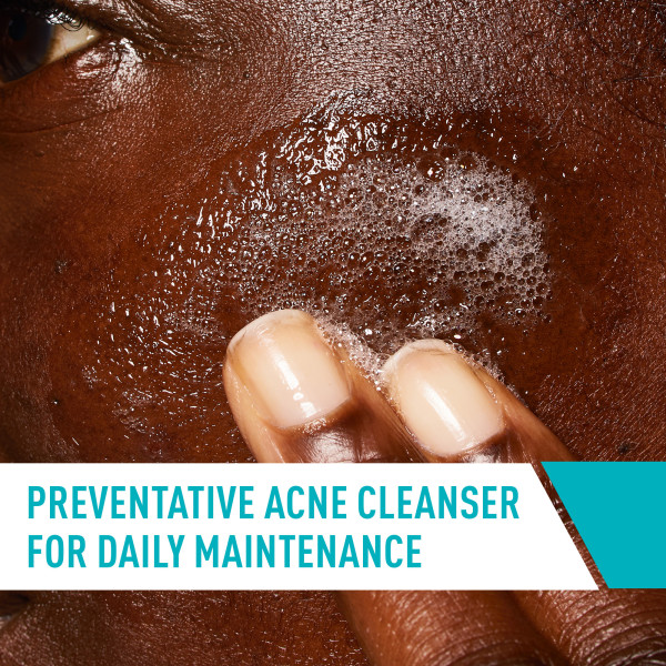 CeraVe Acne Control Cleanser 8 fl. oz.(237ml) - Image 4 of 6
