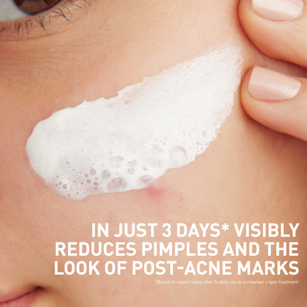 CeraVe Acne Clay-To-Foam Paste Cleanser & Mask 4 fl. oz.(118ml) - Image 3 of 7