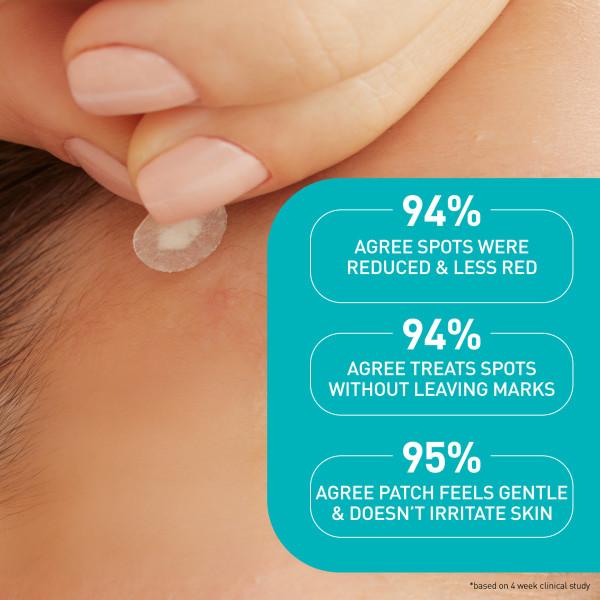 CeraVe Acne Control Patches (22ct) - Image 6 of 8
