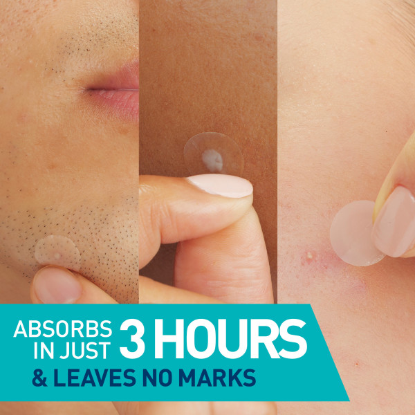 CeraVe Acne Control Patches (22ct) - Image 2 of 8