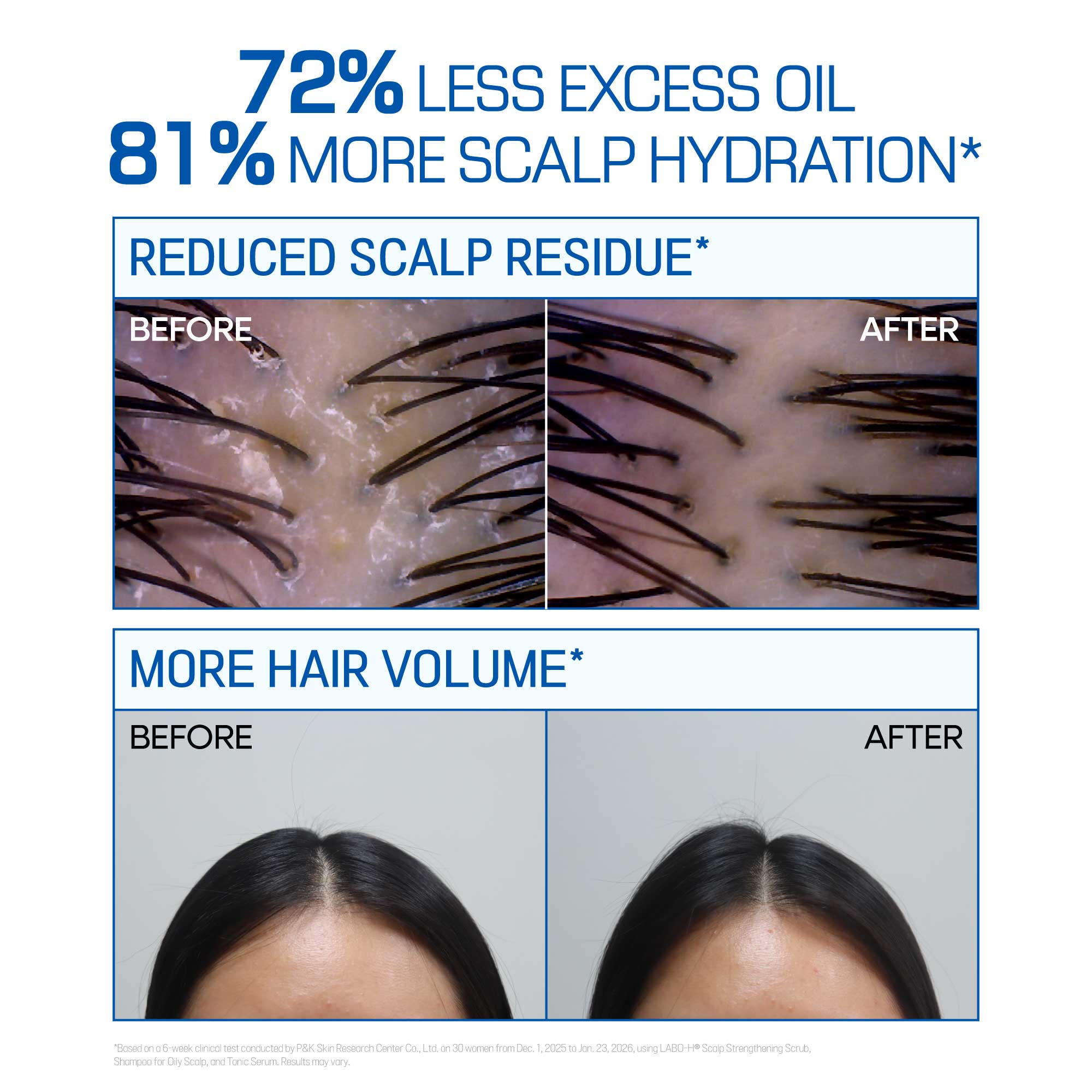 [2options] LABO-H Scalp Strengthening Shampoo for Oily Scalp 29.5 fl. oz.(875ml) (Single / Set) - Image 3 of 6