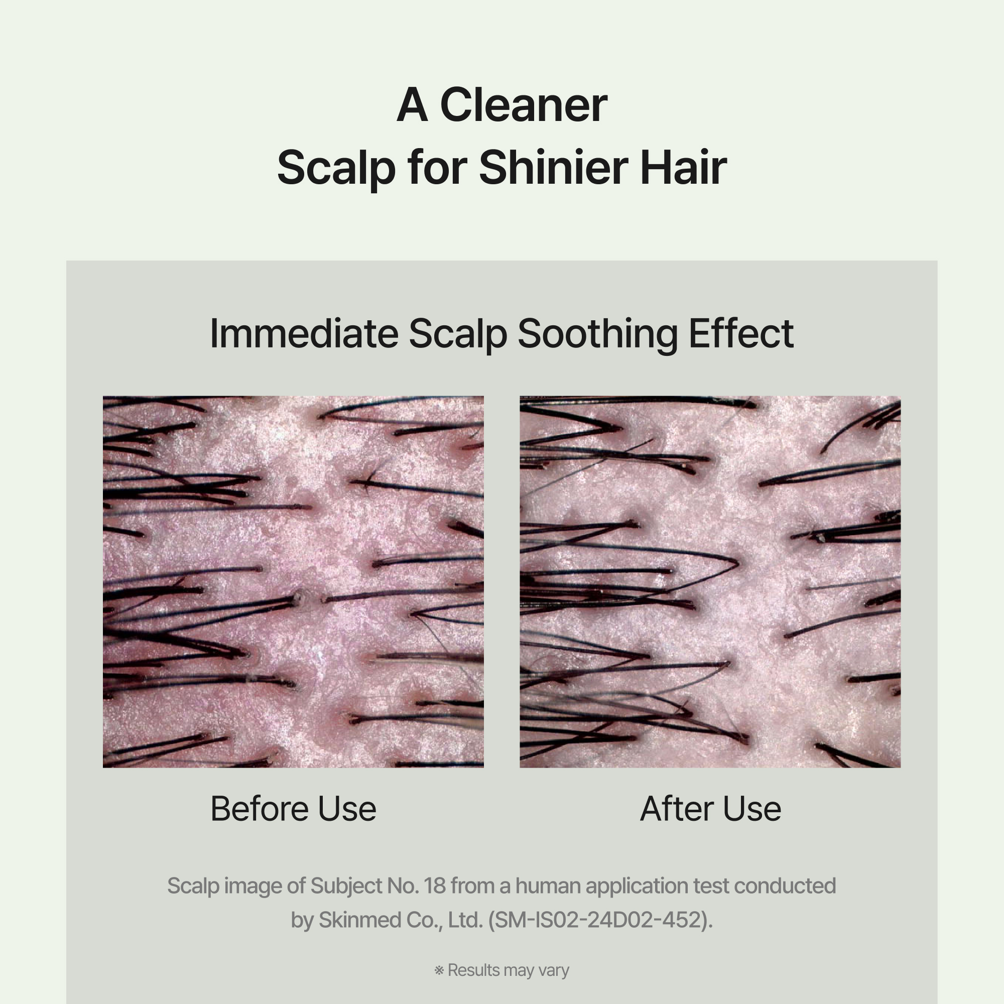 [2options] CHUNGMIJUNG Kelp Shampoo 17.57 fl. oz.(520ml) (Single / Set) - Image 5 of 5