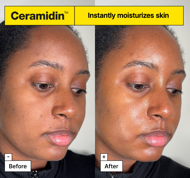 Dr.Jart+ Ceramidin™ Skin Barrier Moisturizing Cream 1.69 fl. oz.(50ml) - Image 4 of 8