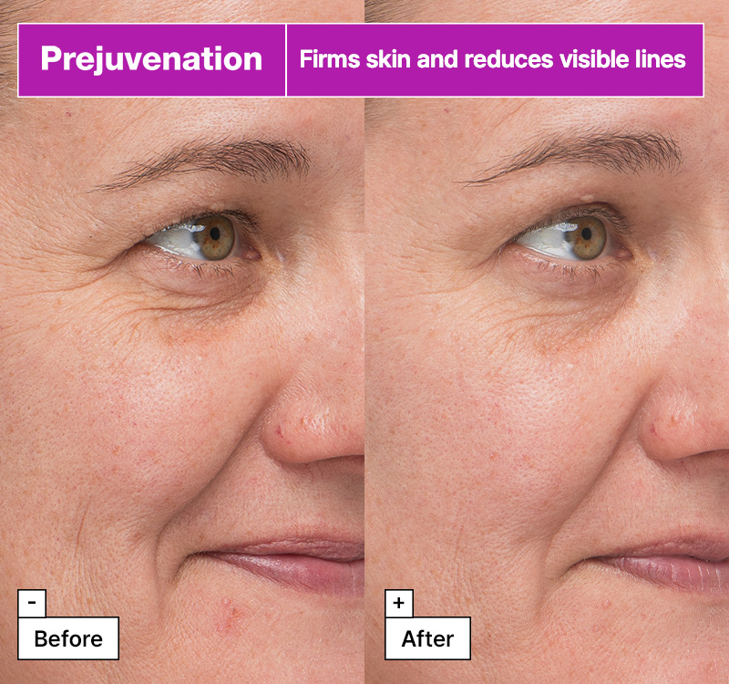 Dr.Jart+ Prejuvenation Firming Bakuchiol Serum 1.69 fl. oz.(50ml) - Image 3 of 6