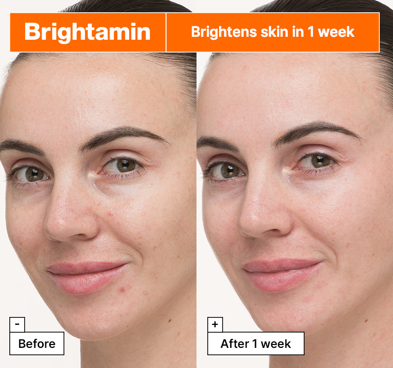 Dr.Jart+ Brightamin Brightening Serum Ampoule : Liquid Serum 0.28 oz.(7g) + Vitamin Ball 0.0028 oz.(0.08g) - Image 3 of 7