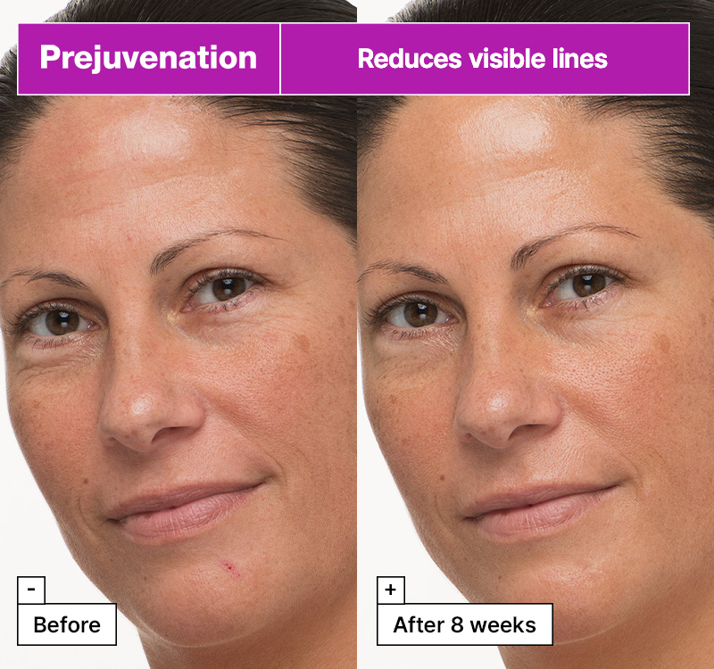 Dr.Jart+ Prejuvenation Firming Bakuchiol Cream  1.69 fl. oz.(50ml) - Image 3 of 6