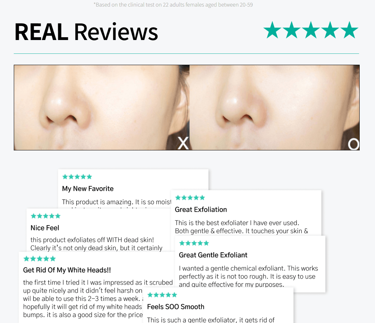 Dr.G Brightening Peeling Gel 4.23 oz.(120g) Set +2.12 oz.(60g) + Serum 0.07 fl. oz.(2ml) detail 3