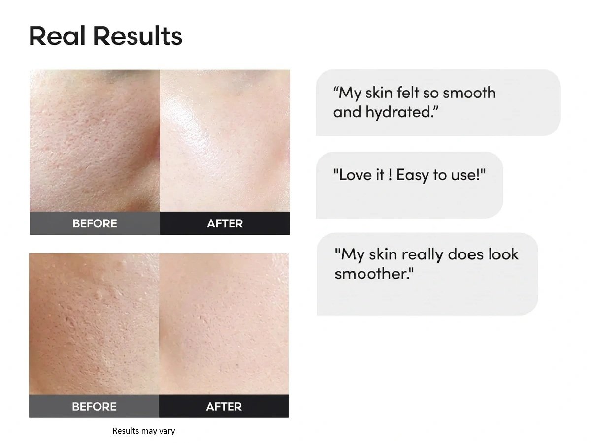 frankly Closer Serum 1.0 fl. oz.(30ml) detail 3