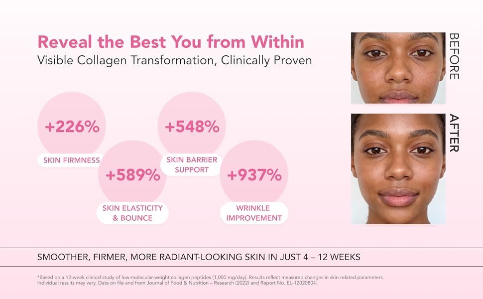 EVER COLLAGEN In & Up Bioton Cell 4 Weeks 1.48 oz.(42g) detail 4