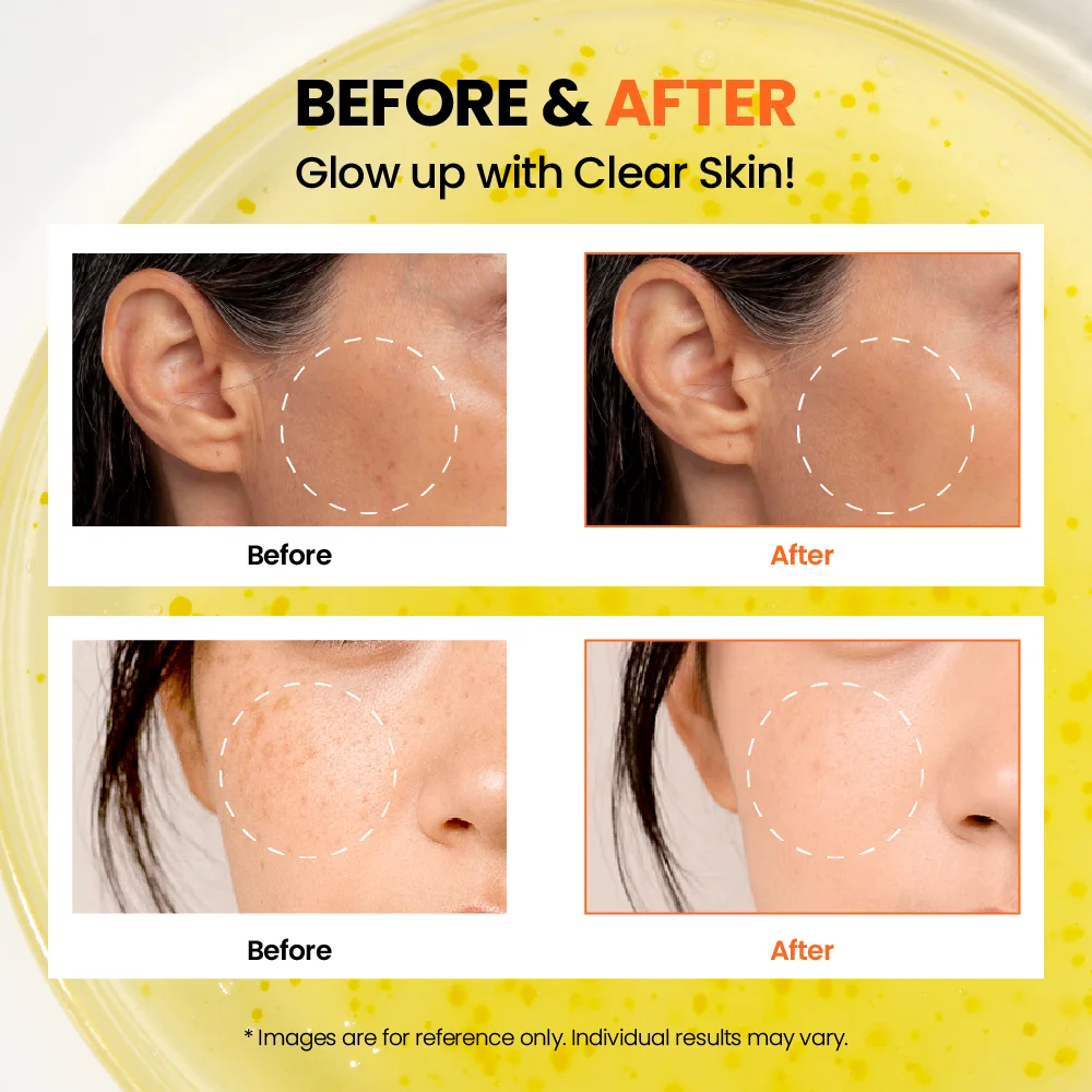 K-SECRET Seoul 1988 Glow Serum : Niacinamide 15% + Yuja 1.01 fl. oz.(30ml) detail 6
