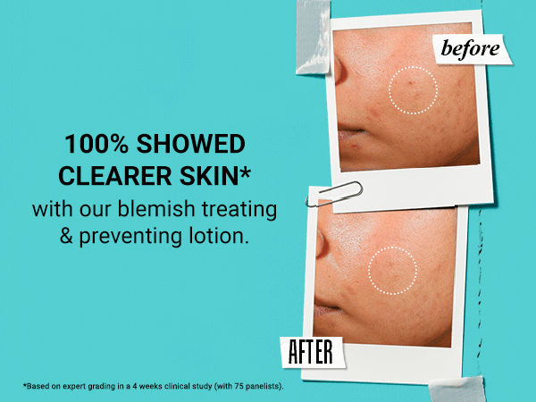 Kiehl's Expertly Clear Moisturizer For Acne Prone Skin With Salicylic Acid 2.0 fl. oz.(60ml) detail 2