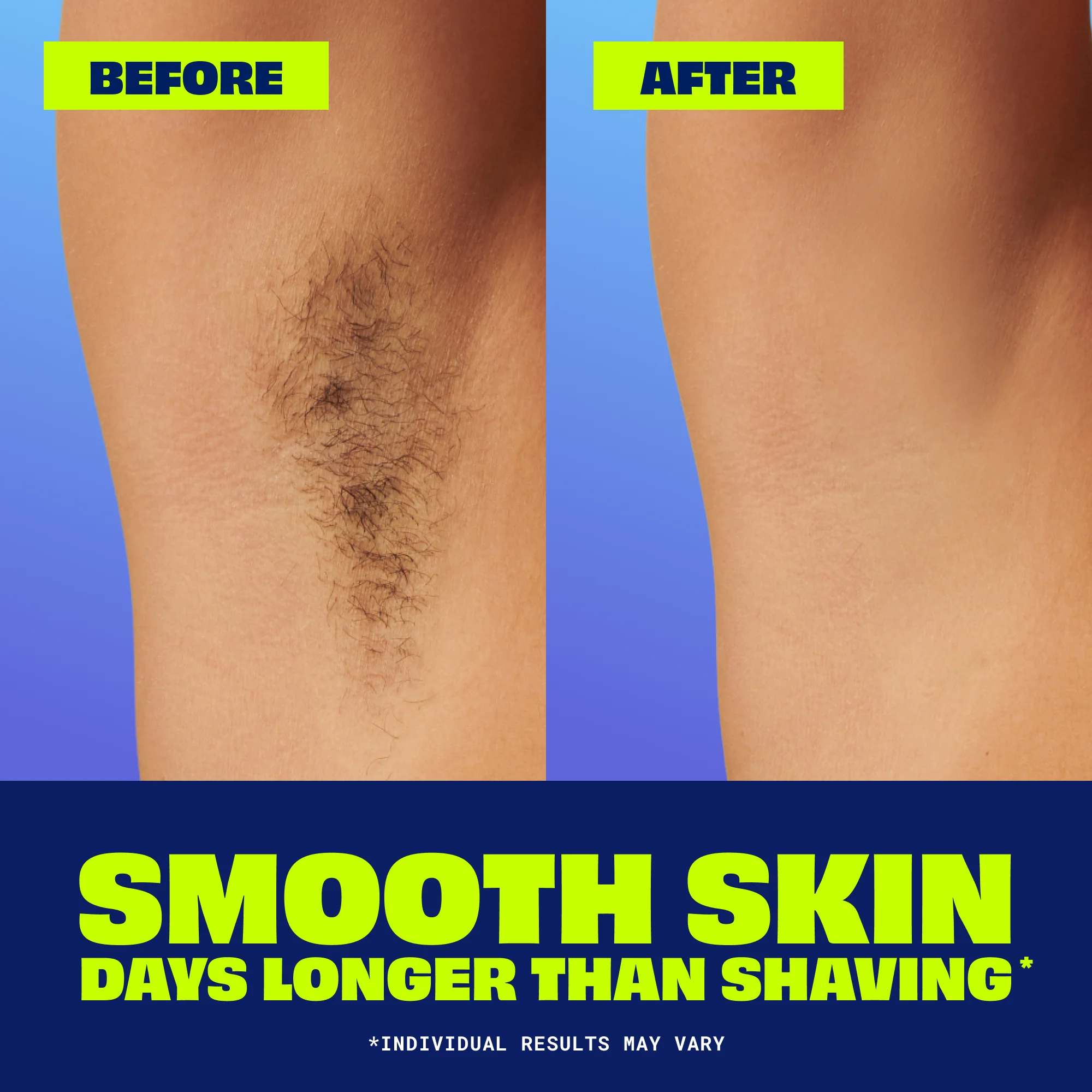 NAIR Glide On Hair Removal Cream For Body, 3.3 oz. (93g) detail 2
