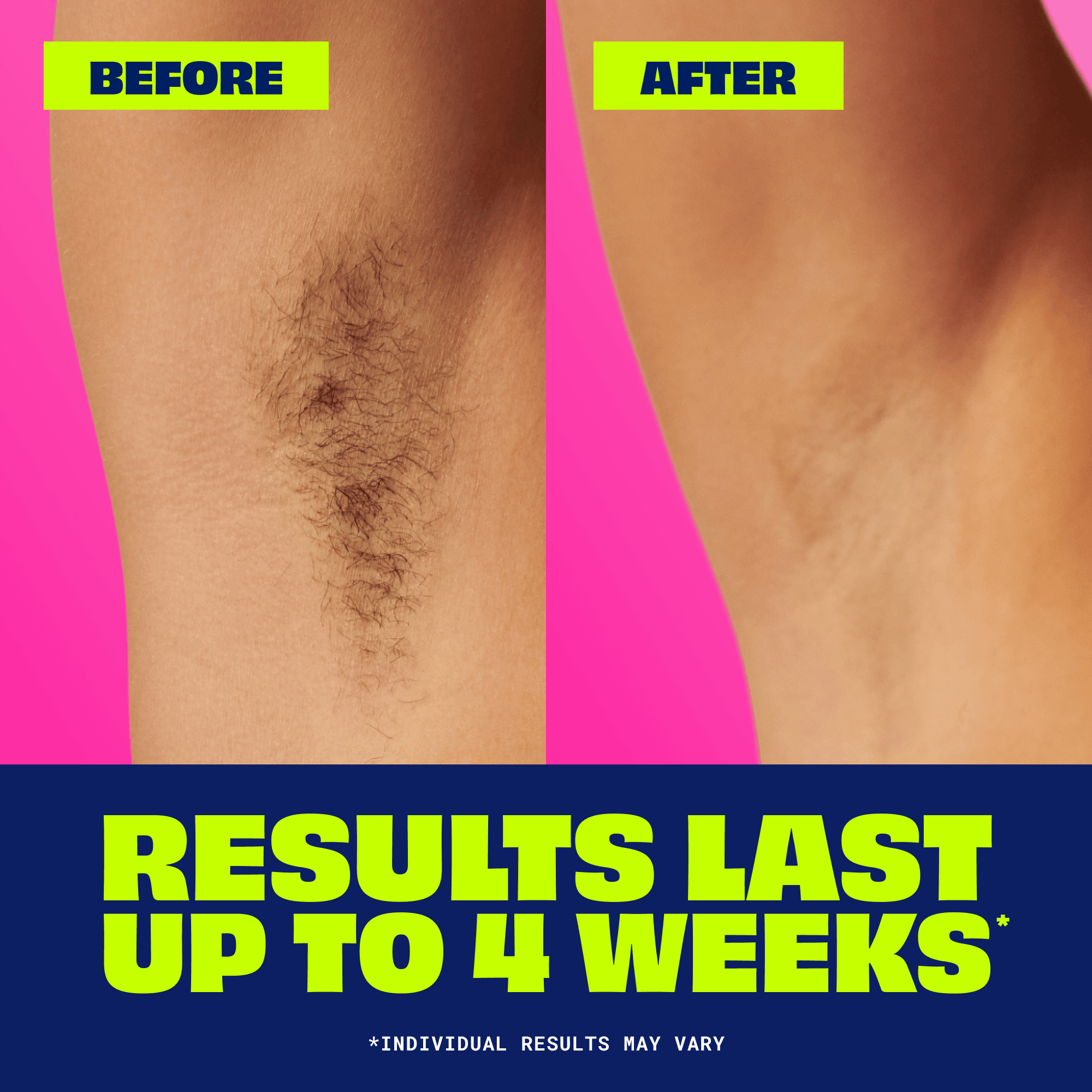 NAIR Hair Remover Mess-free Wax Ready Strips, Legs And Body Easy Hair Removal Wax Strips, 40 Count detail 2