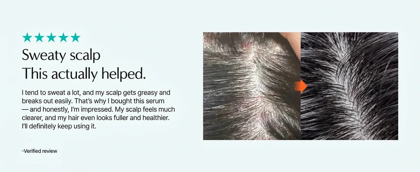 lilyeve Scalp:turn Cica PDRN Brush Ampoule 3.38 fl. oz.(100ml) detail 9