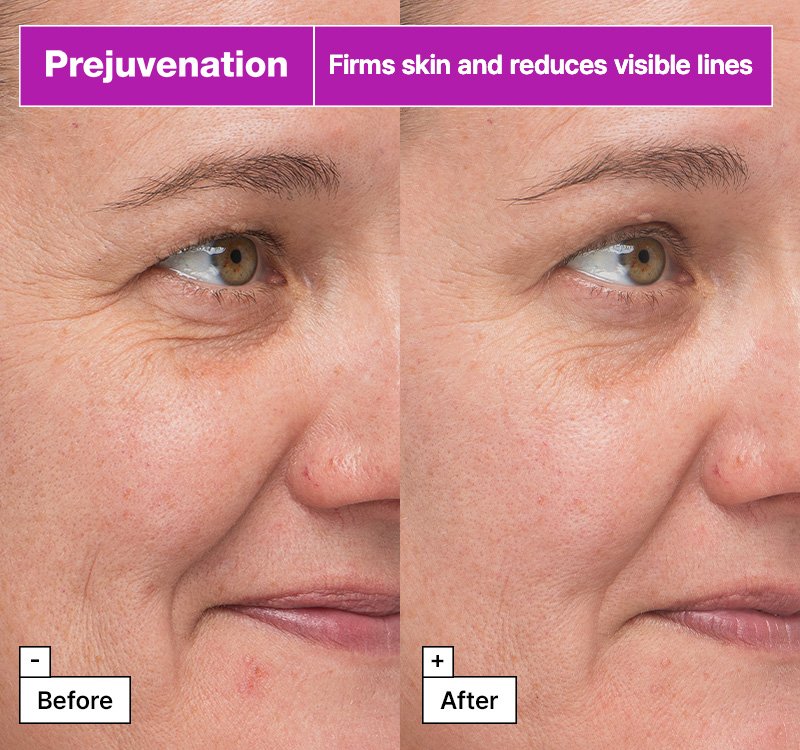 Dr.Jart+ Prejuvenation Firming Bakuchiol Serum 1.69 fl. oz.(50ml) detail 2