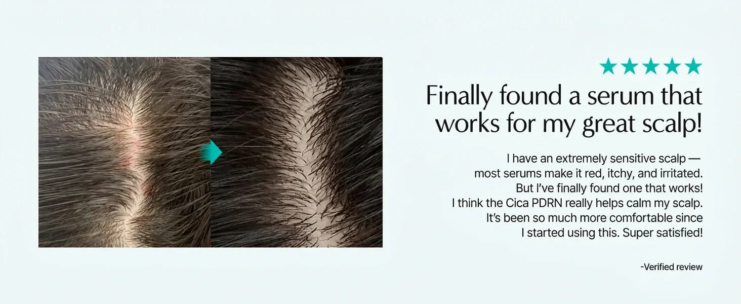 lilyeve Scalp:turn Cica PDRN Brush Ampoule 3.38 fl. oz.(100ml) detail 8