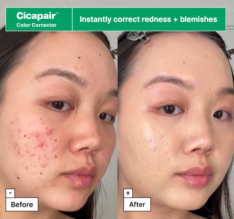 Dr.Jart+ Cicapair™ Redness Rescue Regimen Kit : Mask 0.88 oz. + Serum 0.23 fl. oz. + Cream 0.50 fl. oz. + Treatment 0.50 fl. oz.  detail 3