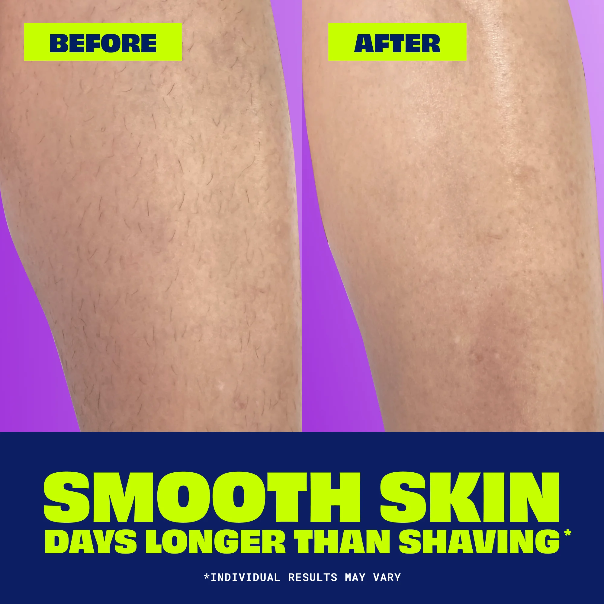 NAIR Body Hair Remover Cream With Rich Cocoa Butter And Vitamin E For Body, Dermatologist Tested 7.9 oz.(226g) detail 3