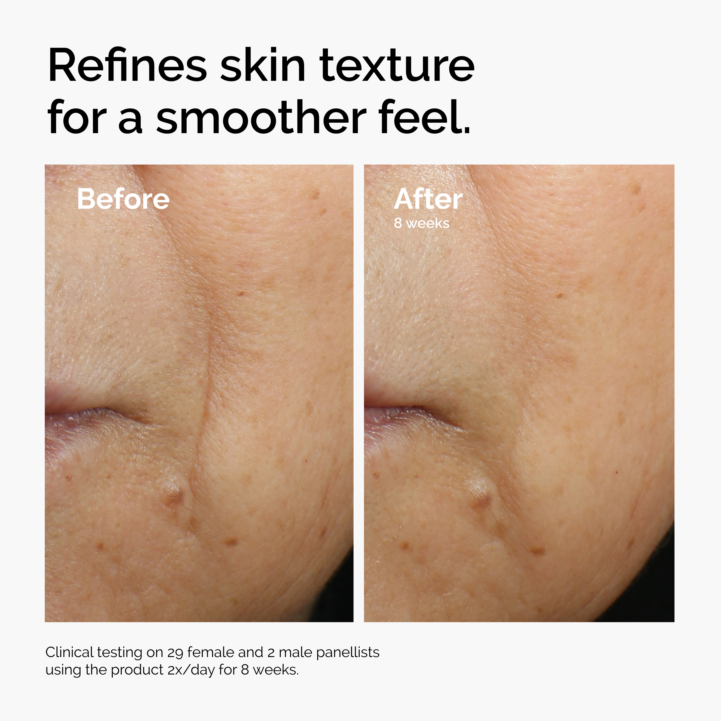The Ordinary Caffeine 3% + Escin 1% Face Serum 1 fl. oz.(30ml) - Image 3 of 6