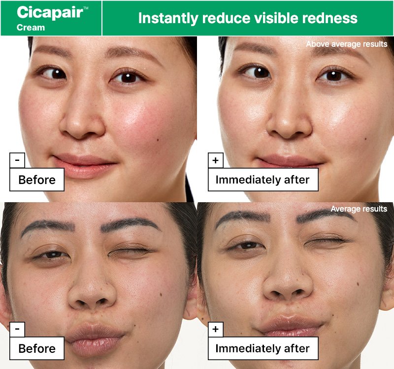 Dr.Jart+ Cicapair™ Redness Rescue Regimen Kit : Mask 0.88 oz. + Serum 0.23 fl. oz. + Cream 0.50 fl. oz. + Treatment 0.50 fl. oz.  detail 6