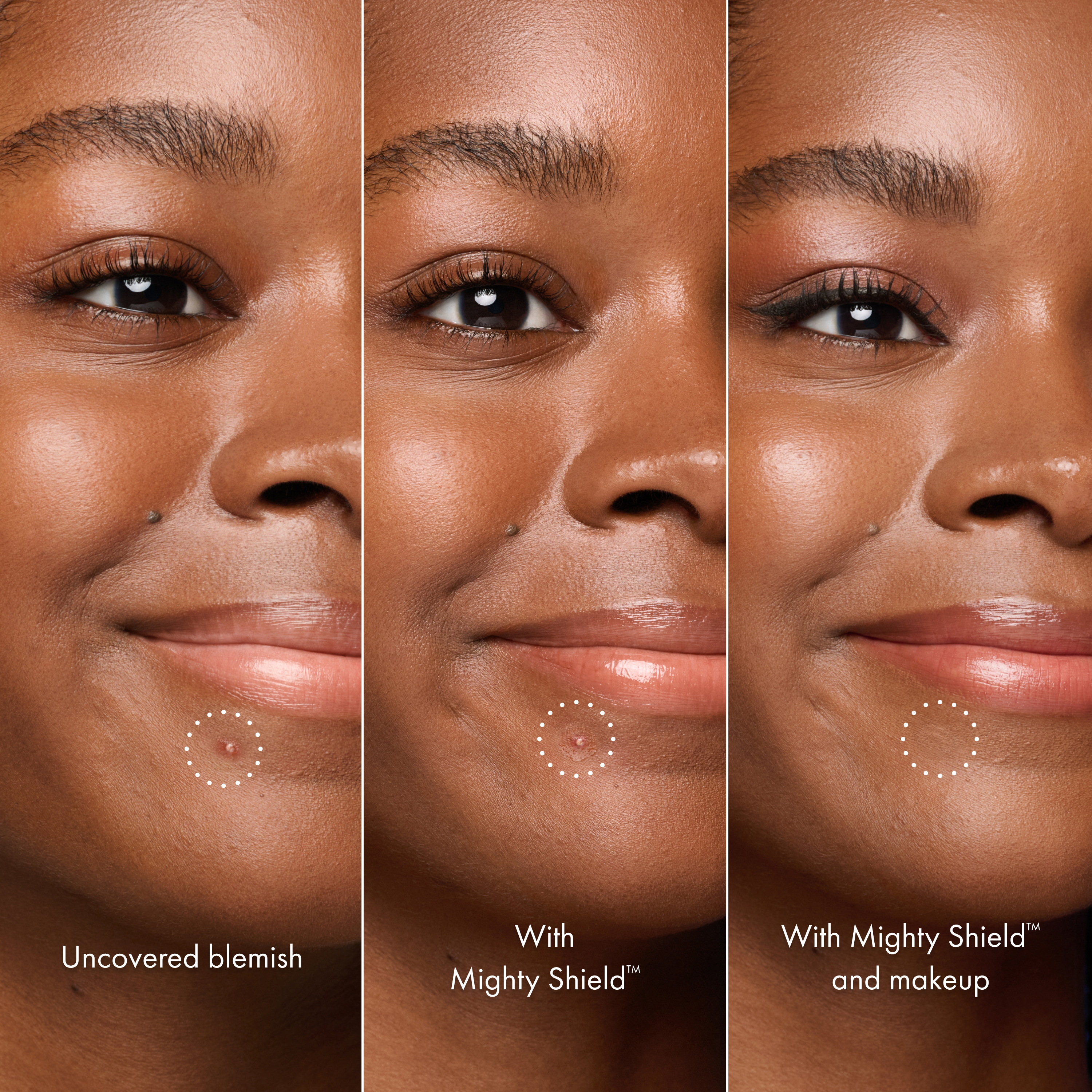 HERO Cosmetics Mighty Shield™ Liquid Patch Invisible Blemish Protectant 0.34 fl. oz.(10ml) detail 3