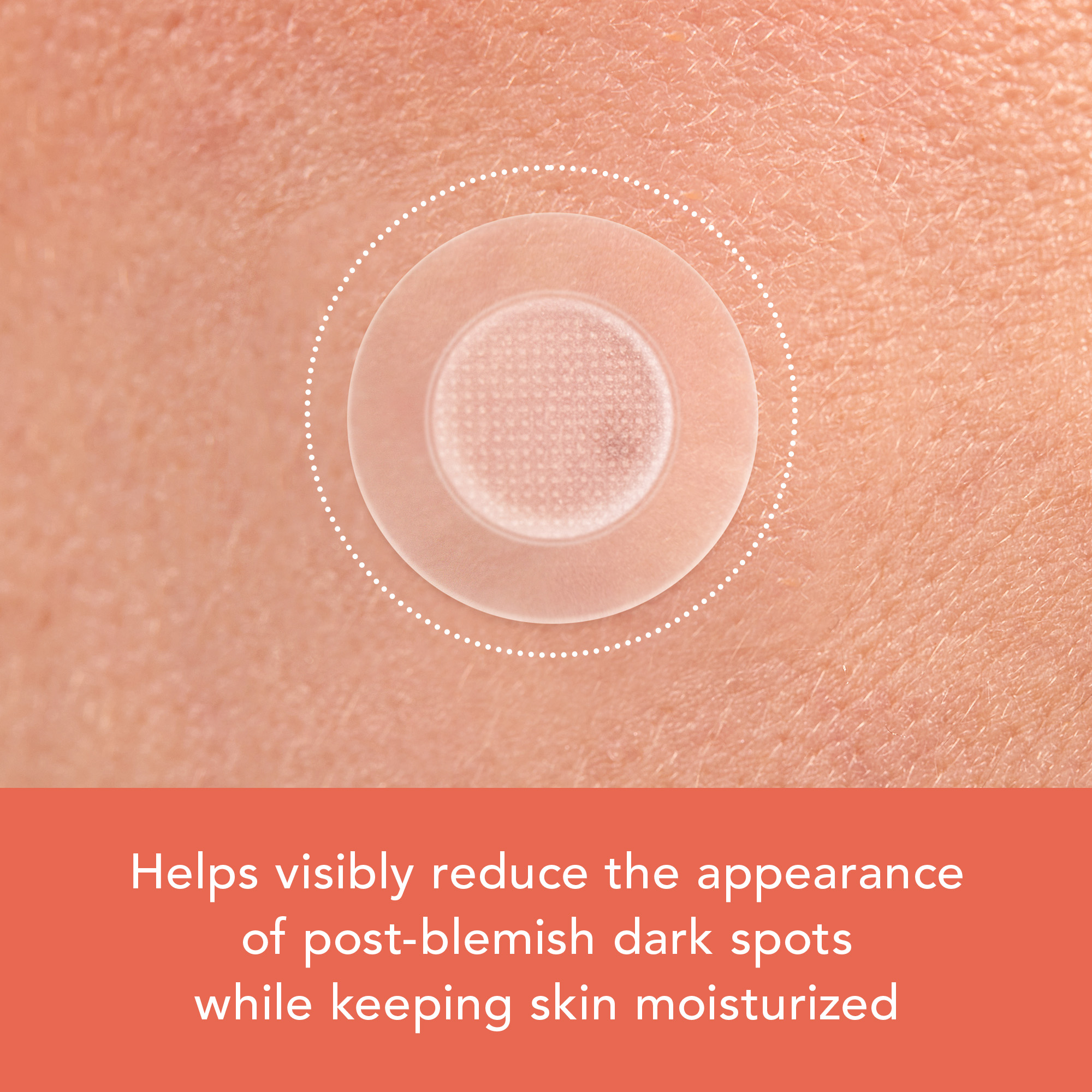 Rael Beauty Miracle Patch Vitamin C Dark Spot Cover (9ct) - Image 4 of 6