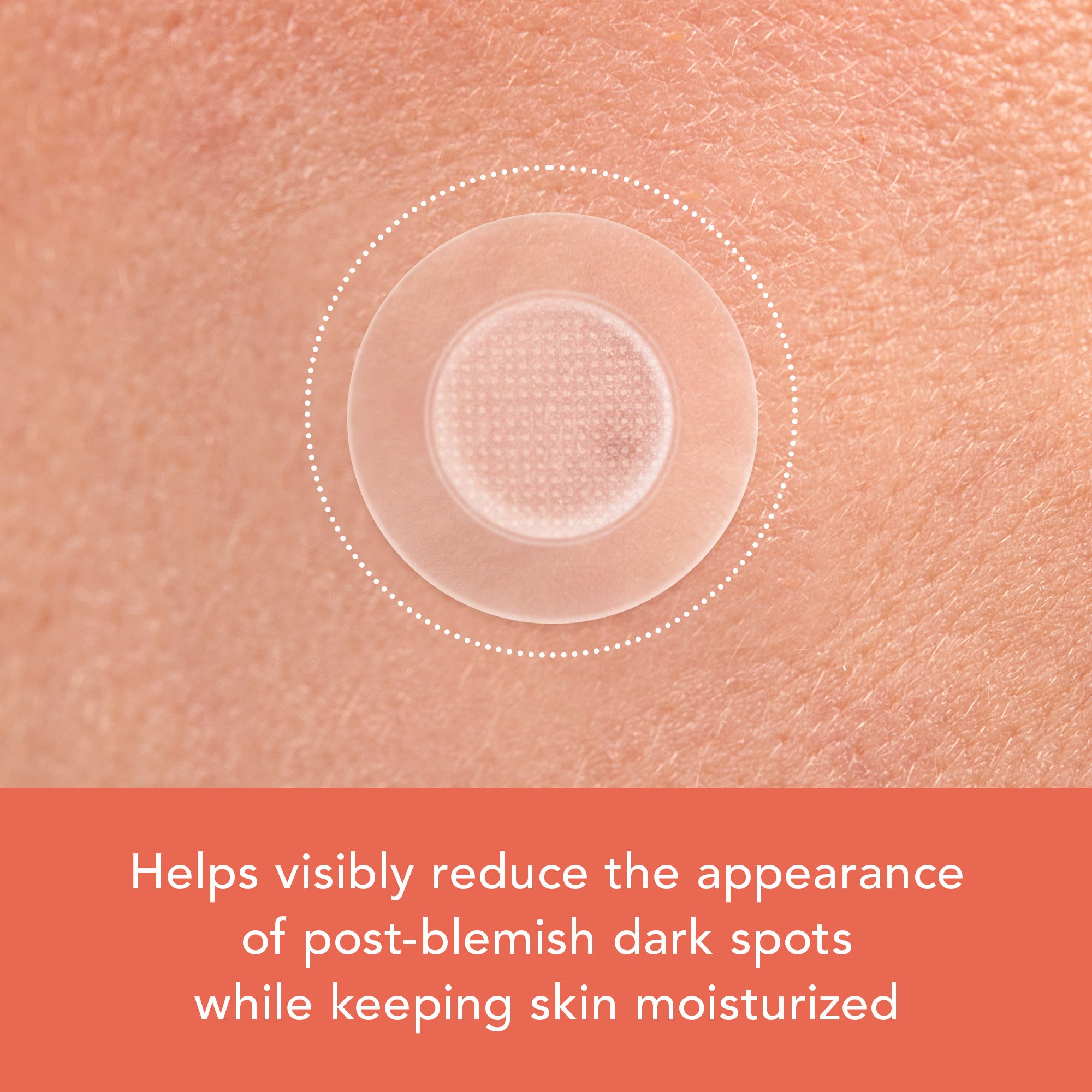 Rael Beauty Miracle Patch Vitamin C Dark Spot Cover (9ea) detail 3