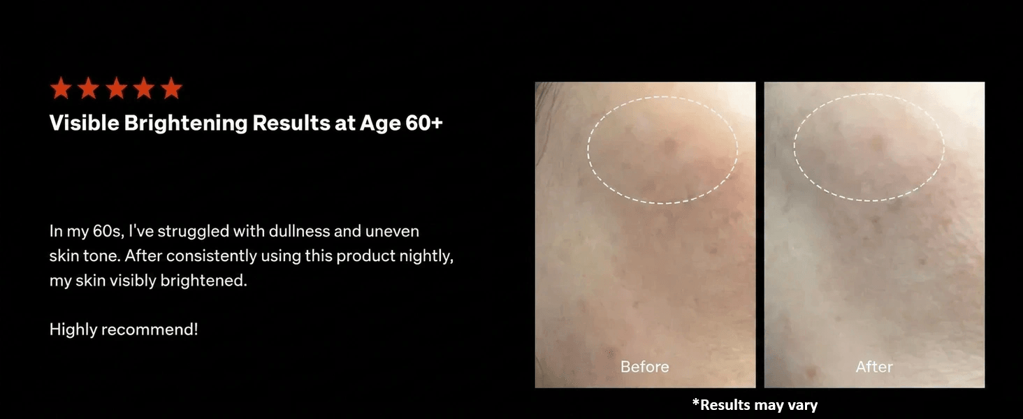 l glutathione before after pictures PURCELL 88b/ml L-glutathione Flexible Liposome 1.01 fl. oz.(30ml) Stable Gastric Pentadecapeptide BPC Size:Hospira Pfizer® – Bacteriostatic Water | 30 mL (Single Vial) Face Care