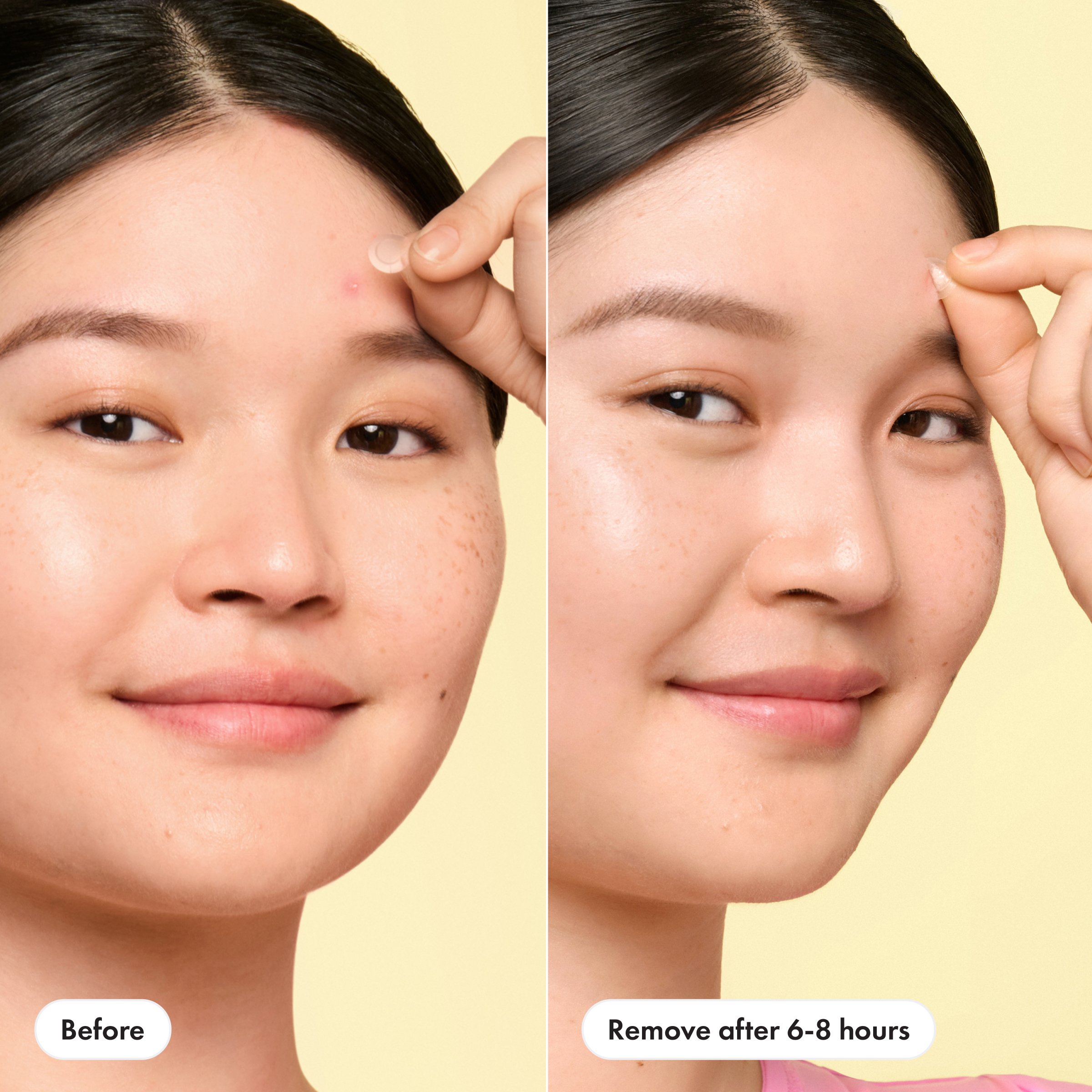 HERO Cosmetics Mighty Patch Invisible+ Mini (30ea) detail 2