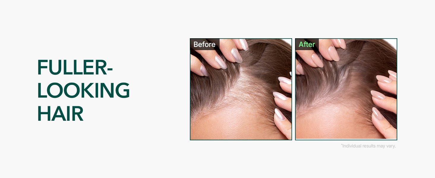ViveLab Revive Therapy Hair Scalp Enhancing Foam 3.38 fl. oz.(100ml)(E) detail 2