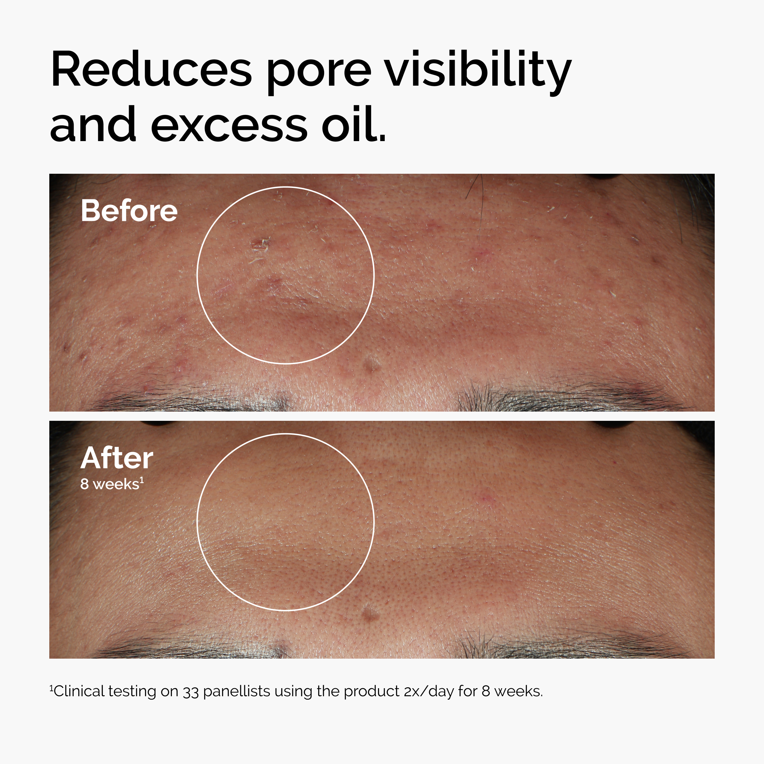 The Ordinary Niacinamide 10% + Zinc 1% 1 fl. oz.(30ml) detail 1