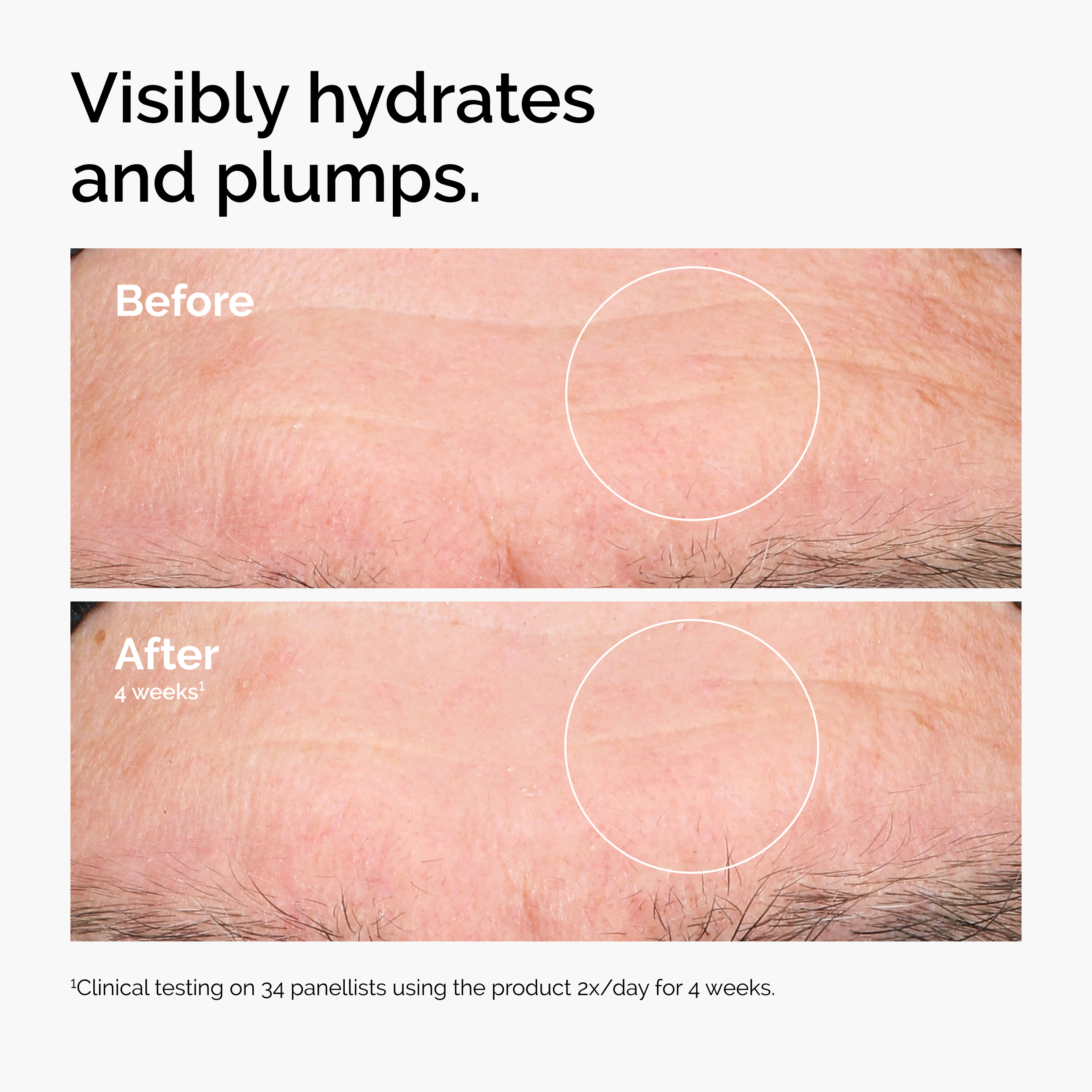 The Ordinary Hyaluronic Acid 2% + B5 (with Ceramides)1 fl. oz.(30ml) - Image 3 of 8