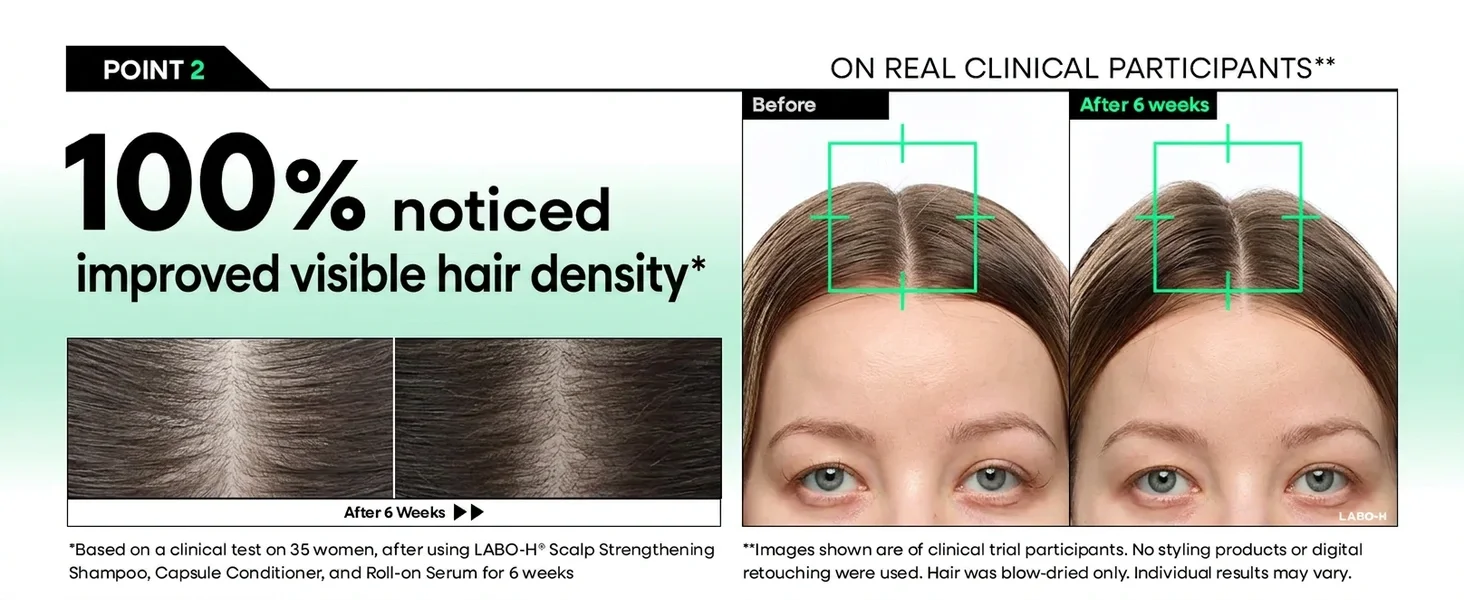 LABO-H Scalp Strengthening Roll-on Serum 0.5 fl. oz.(15ml) detail 4
