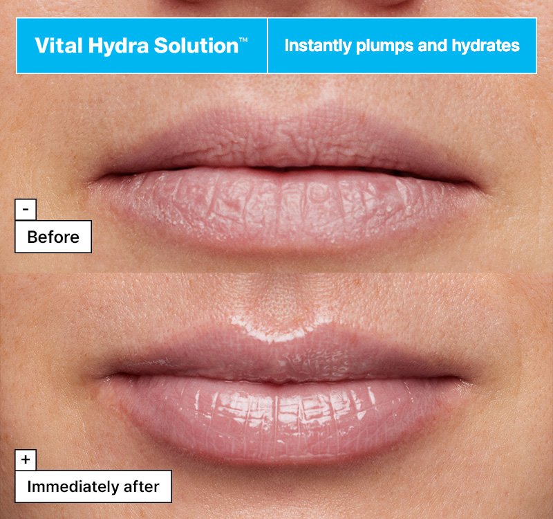 Dr.Jart+ Vital Hydra Solution™ Hydrating Lip Mask 0.67 fl. oz.(20ml) detail 3