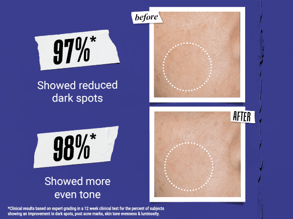 Kiehl's Clearly Corrective Dark Spot Solution 1.0 fl. oz.(30ml) detail 2